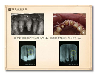 歯周病・審美・咬合補綴1-2