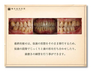 歯周病・審美・咬合補綴1-4