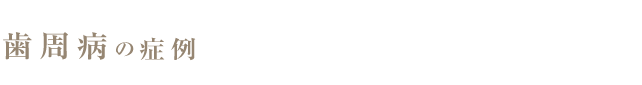 歯周病
