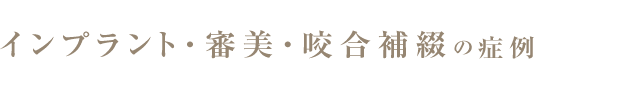 インプラント・審美・咬合補綴