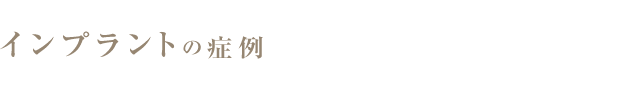 インプラント