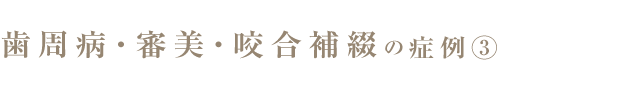 歯周病・審美・咬合補綴3
