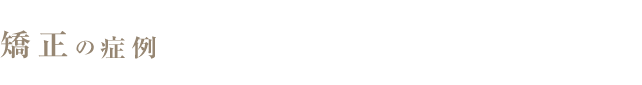 矯正