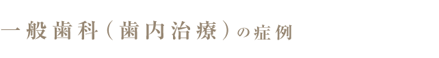 一般歯科（歯内治療）