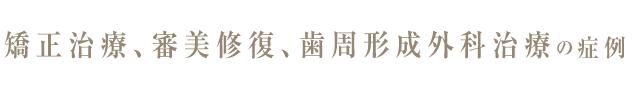 審美