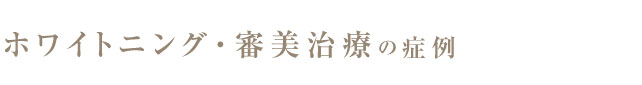ホワイトニング
